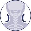 Immobilisering