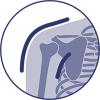 Immobilisering