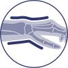 Immobilisering